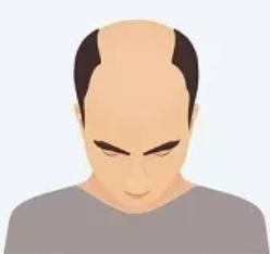 Stage 2