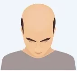 Stage 4